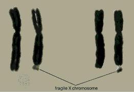 kromosoma